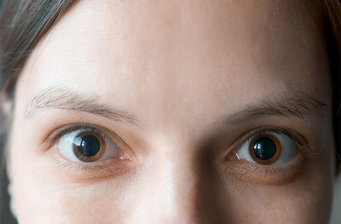 What Not To Do After Eye Dilation What You Must Keep In Mind
